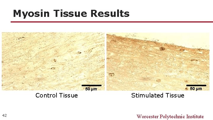 Myosin Tissue Results 50 µm Control Tissue 42 Stimulated Tissue Worcester Polytechnic Institute 