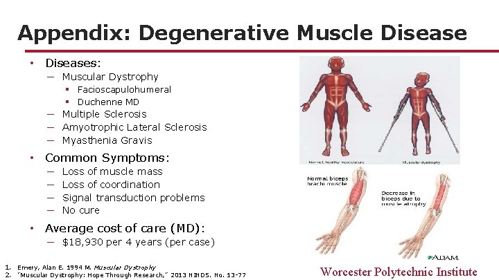Appendix: Degenerative Muscle Disease • Diseases: ─ Muscular Dystrophy § Facioscapulohumeral § Duchenne MD