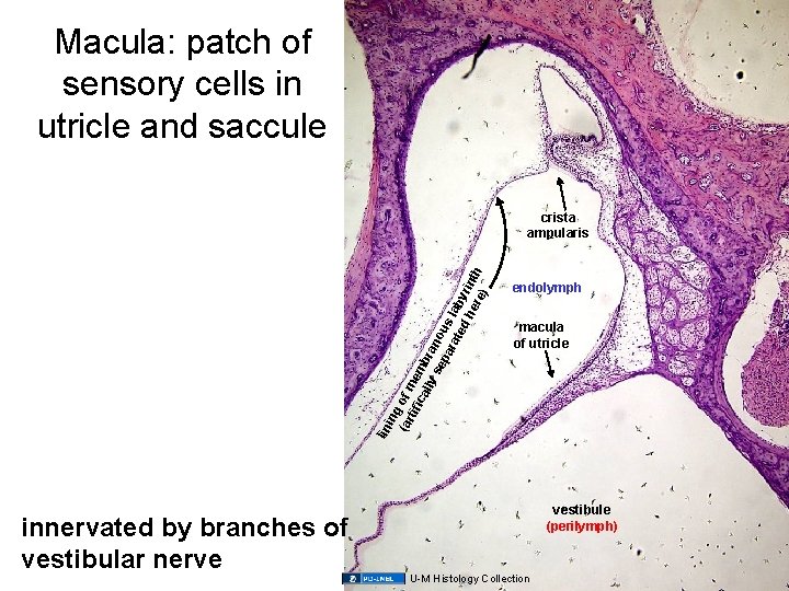 Macula: patch of sensory cells in utricle and saccule endolymph macula of utricle lin