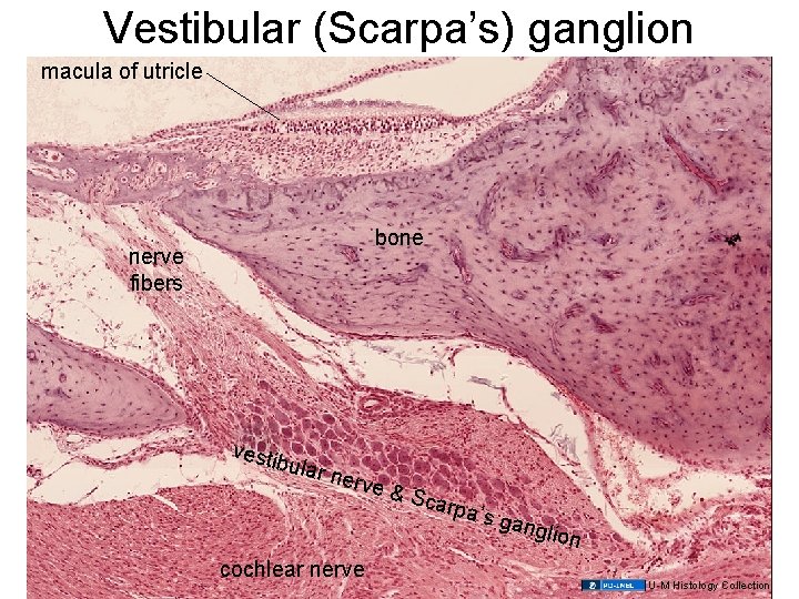 Vestibular (Scarpa’s) ganglion macula of utricle bone nerve fibers vesti bular nerv cochlear nerve