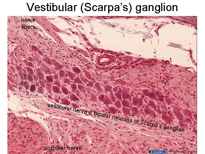 Vestibular (Scarpa’s) ganglion nerve fibers vestibu l ar nerv e & bip olar ne