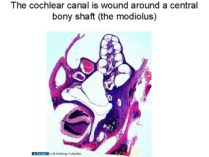 The cochlear canal is wound around a central bony shaft (the modiolus) U-M Histology