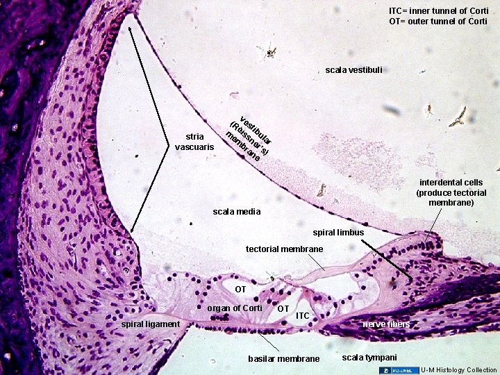 ITC= inner tunnel of Corti OT= outer tunnel of Corti scala vestibuli stria vascuaris