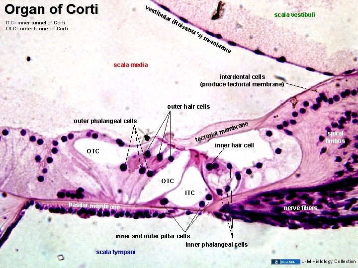 Organ of Corti ve sti b ITC= inner tunnel of Corti OTC= outer tunnel