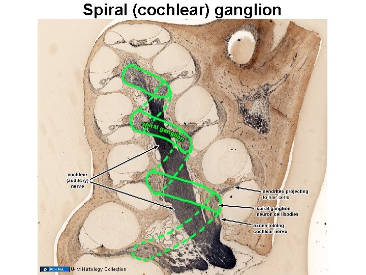 Spiral (cochlear) ganglion U-M Histology Collection 