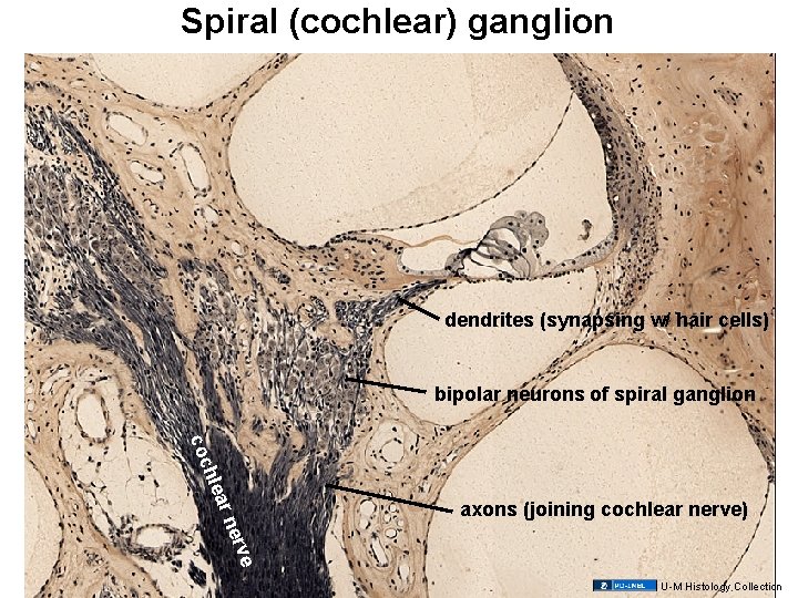 Spiral (cochlear) ganglion dendrites (synapsing w/ hair cells) bipolar neurons of spiral ganglion e