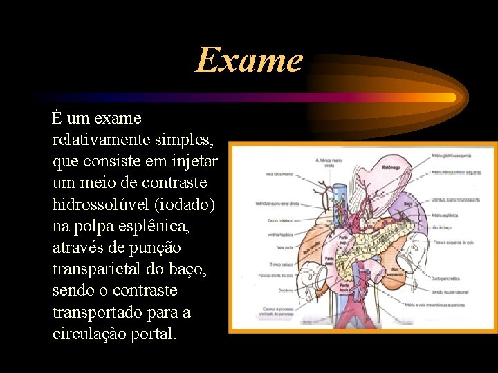 Exame É um exame relativamente simples, que consiste em injetar um meio de contraste