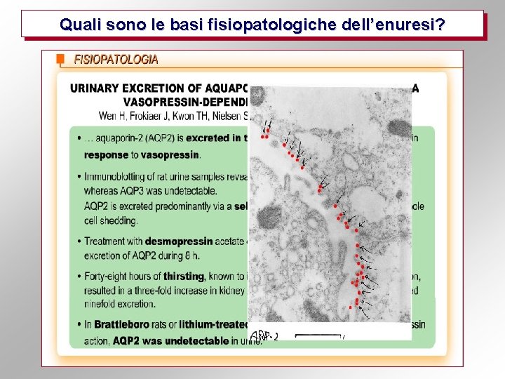 Quali sono le basi fisiopatologiche dell’enuresi? 