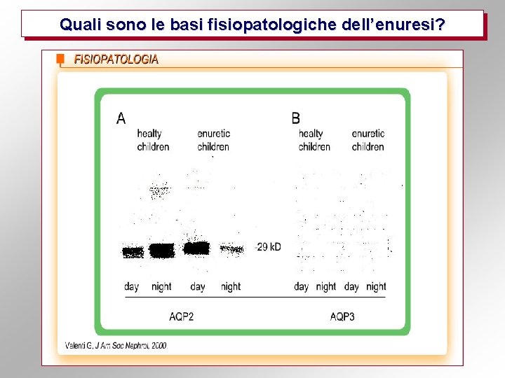 Quali sono le basi fisiopatologiche dell’enuresi? 