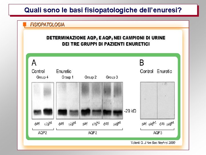 Quali sono le basi fisiopatologiche dell’enuresi? 