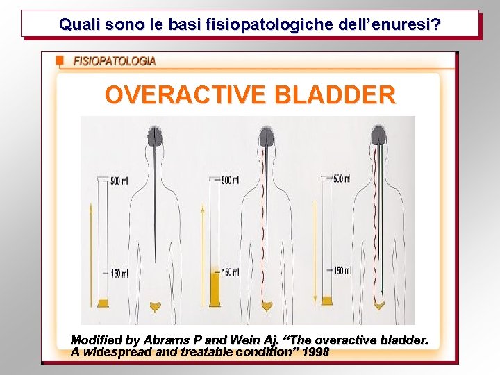 Quali sono le basi fisiopatologiche dell’enuresi? OVERACTIVE BLADDER Modified by Abrams P and Wein