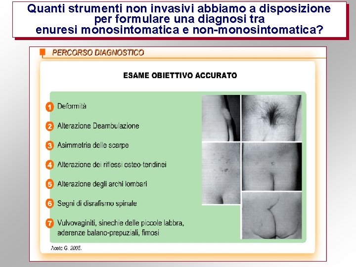Quanti strumenti non invasivi abbiamo a disposizione per formulare una diagnosi tra enuresi monosintomatica