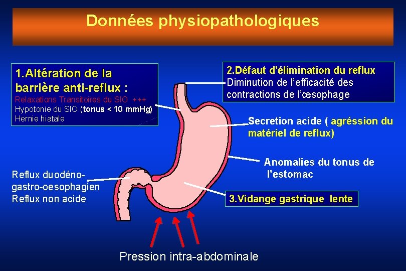 Données physiopathologiques 1. Altération de la barrière anti-reflux : Relaxations Transitoires du SIO +++