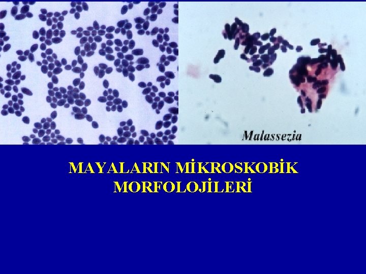 MAYALARIN MİKROSKOBİK MORFOLOJİLERİ 