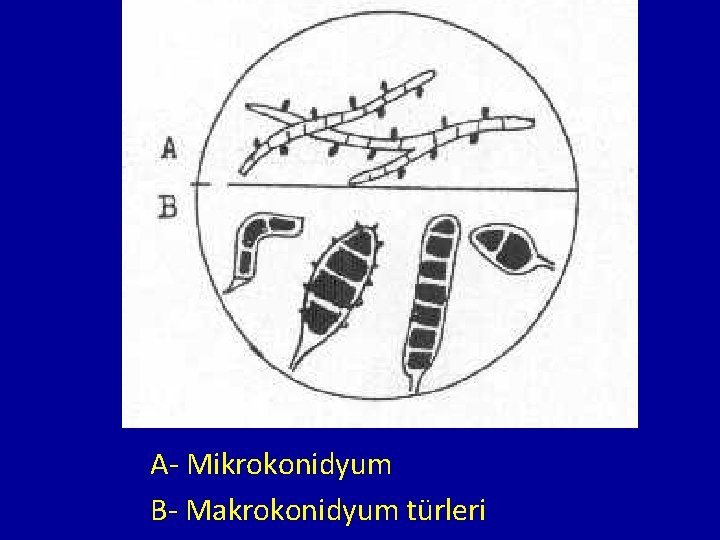 A- Mikrokonidyum B- Makrokonidyum türleri 