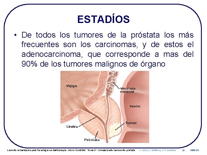 ESTADÍOS • De todos los tumores de la próstata los más frecuentes son los