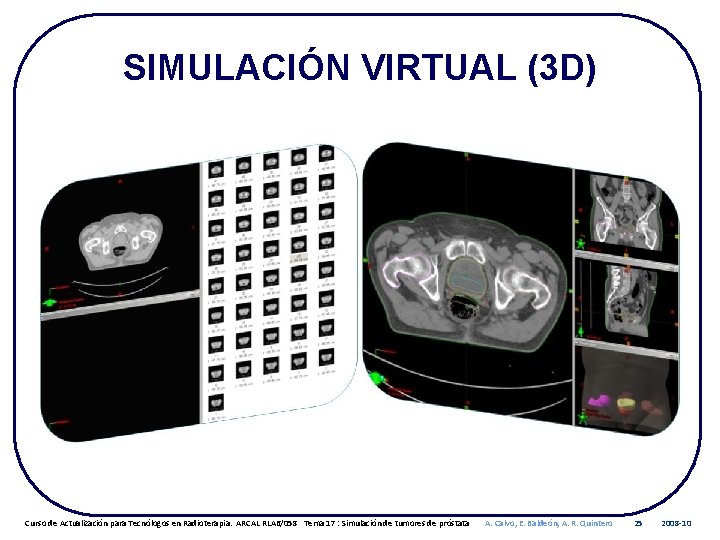 SIMULACIÓN VIRTUAL (3 D) Curso de Actualización para Tecnólogos en Radioterapia. ARCAL RLA 6/058