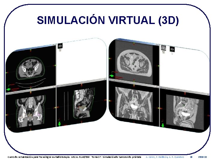 SIMULACIÓN VIRTUAL (3 D) Curso de Actualización para Tecnólogos en Radioterapia. ARCAL RLA 6/058