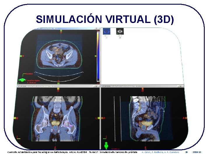 SIMULACIÓN VIRTUAL (3 D) Curso de Actualización para Tecnólogos en Radioterapia. ARCAL RLA 6/058