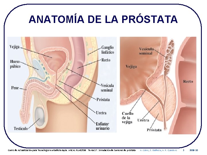 ANATOMÍA DE LA PRÓSTATA Curso de Actualización para Tecnólogos en Radioterapia. ARCAL RLA 6/058