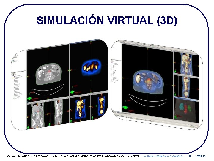 SIMULACIÓN VIRTUAL (3 D) Curso de Actualización para Tecnólogos en Radioterapia. ARCAL RLA 6/058