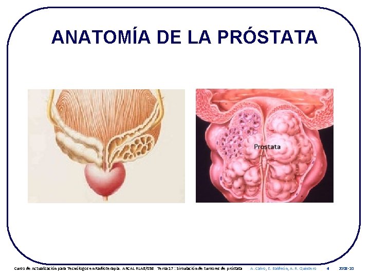 ANATOMÍA DE LA PRÓSTATA Curso de Actualización para Tecnólogos en Radioterapia. ARCAL RLA 6/058