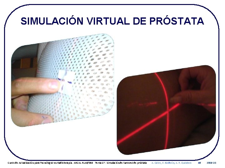 SIMULACIÓN VIRTUAL DE PRÓSTATA Curso de Actualización para Tecnólogos en Radioterapia. ARCAL RLA 6/058