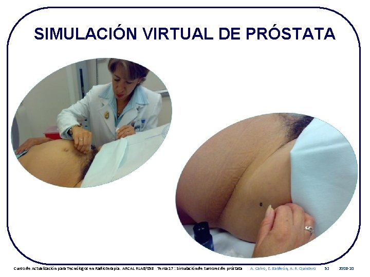 SIMULACIÓN VIRTUAL DE PRÓSTATA Curso de Actualización para Tecnólogos en Radioterapia. ARCAL RLA 6/058