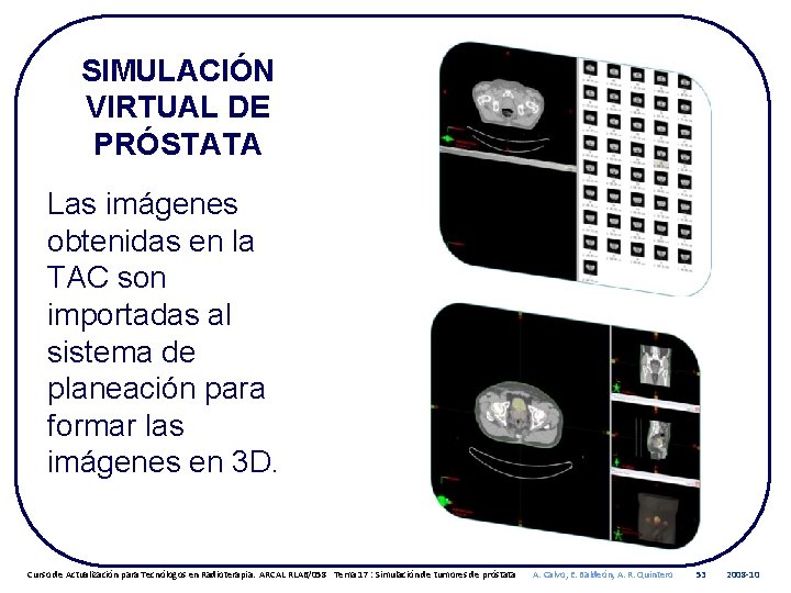 SIMULACIÓN VIRTUAL DE PRÓSTATA Las imágenes obtenidas en la TAC son importadas al sistema