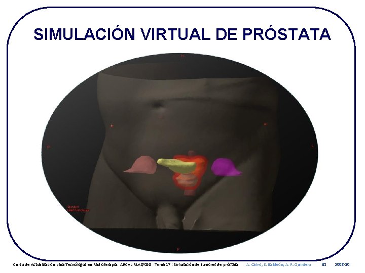 SIMULACIÓN VIRTUAL DE PRÓSTATA Curso de Actualización para Tecnólogos en Radioterapia. ARCAL RLA 6/058