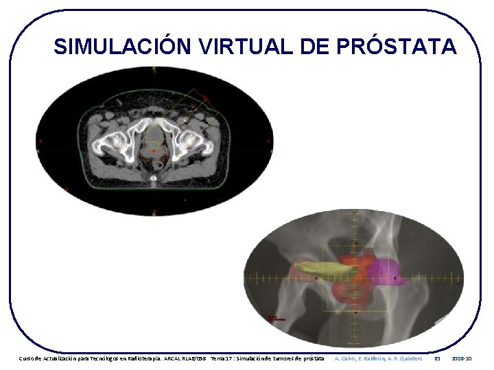 SIMULACIÓN VIRTUAL DE PRÓSTATA Curso de Actualización para Tecnólogos en Radioterapia. ARCAL RLA 6/058