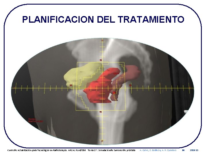 PLANIFICACION DEL TRATAMIENTO Curso de Actualización para Tecnólogos en Radioterapia. ARCAL RLA 6/058 Tema
