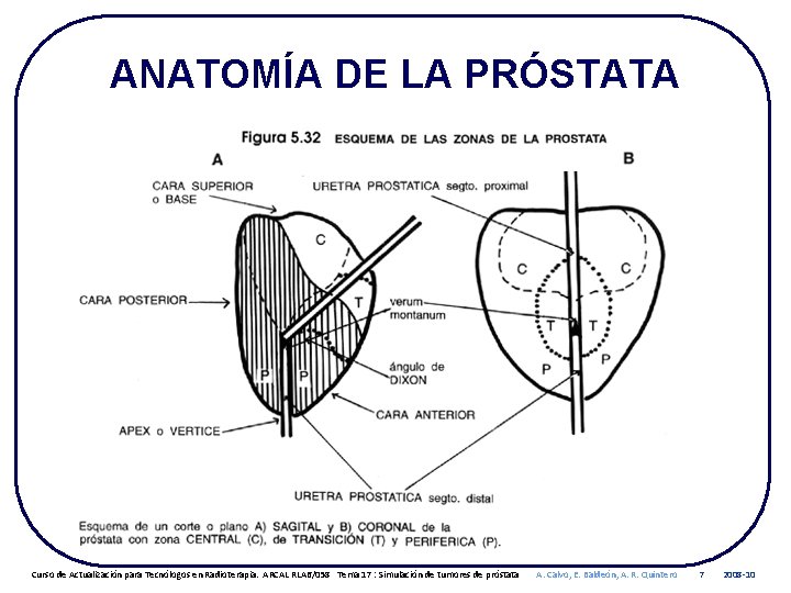 ANATOMÍA DE LA PRÓSTATA Curso de Actualización para Tecnólogos en Radioterapia. ARCAL RLA 6/058