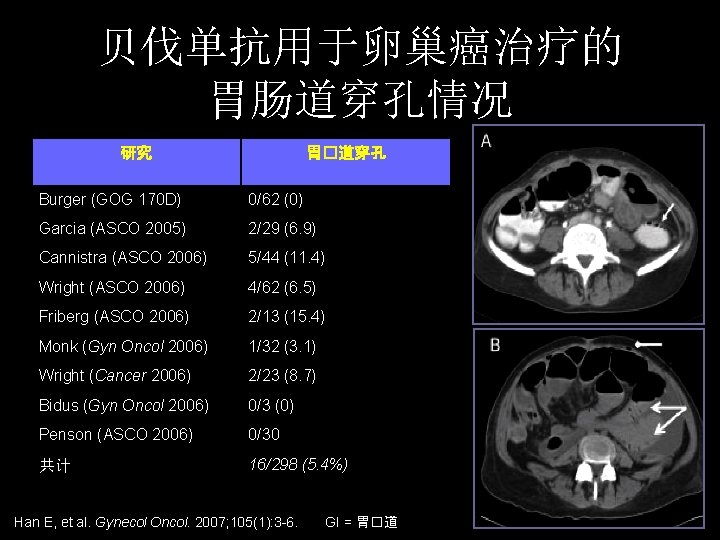 贝伐单抗用于卵巢癌治疗的 胃肠道穿孔情况 研究 胃�道穿孔 Burger (GOG 170 D) 0/62 (0) Garcia (ASCO 2005) 2/29