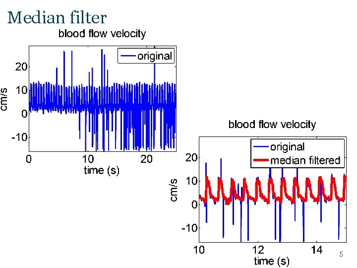 Median filter 5 