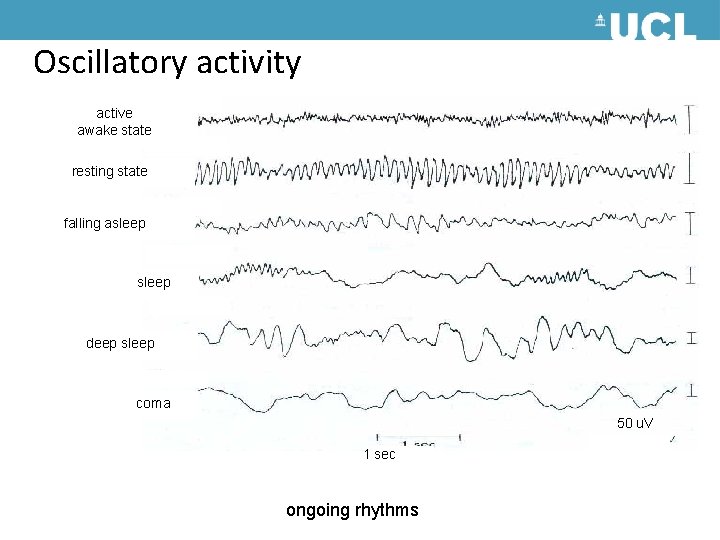 Oscillatory activity active awake state resting state falling asleep deep sleep coma 50 u. Oscillatory activity active awake state resting state falling asleep deep sleep coma 50 u.