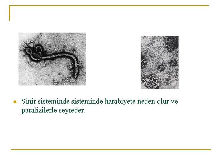 n Sinir sisteminde harabiyete neden olur ve paralizilerle seyreder. 