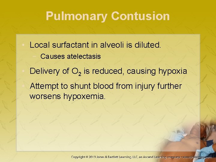 Pulmonary Contusion • Local surfactant in alveoli is diluted. − Causes atelectasis • Delivery
