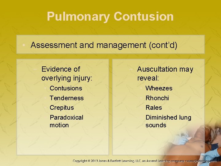 Pulmonary Contusion • Assessment and management (cont’d) − Evidence of overlying injury: • •