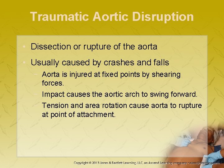 Traumatic Aortic Disruption • Dissection or rupture of the aorta • Usually caused by