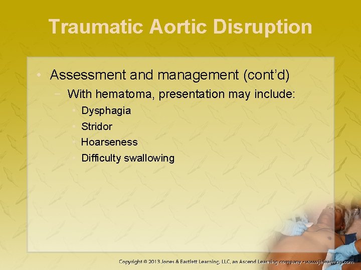 Traumatic Aortic Disruption • Assessment and management (cont’d) − With hematoma, presentation may include: