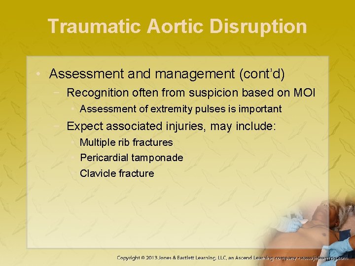 Traumatic Aortic Disruption • Assessment and management (cont’d) − Recognition often from suspicion based