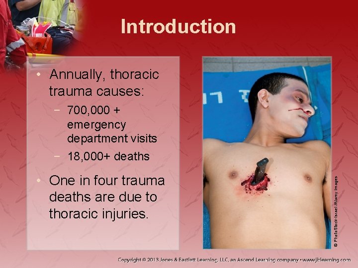 Introduction • Annually, thoracic trauma causes: • One in four trauma deaths are due