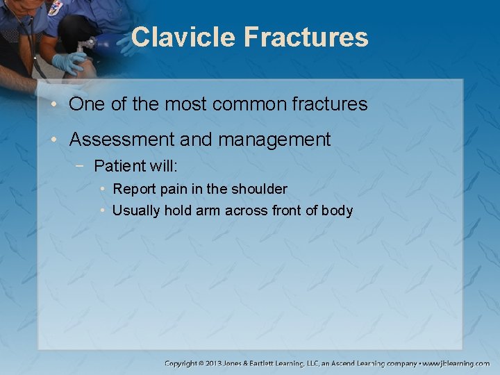 Clavicle Fractures • One of the most common fractures • Assessment and management −