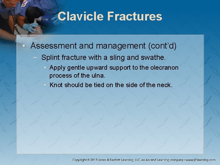 Clavicle Fractures • Assessment and management (cont’d) − Splint fracture with a sling and