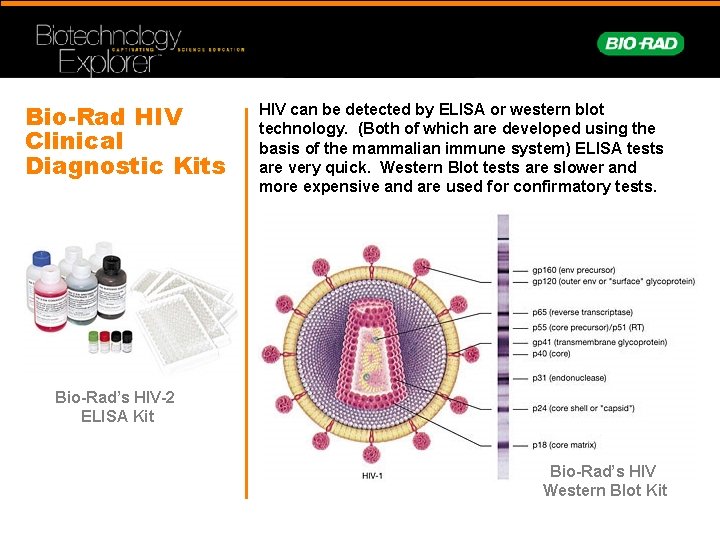 Bio-Rad HIV Clinical Diagnostic Kits HIV can be detected by ELISA or western blot