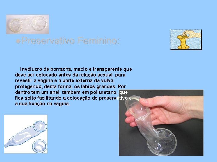 ●Preservativo Feminino: Invólucro de borracha, macio e transparente que deve ser colocado antes da