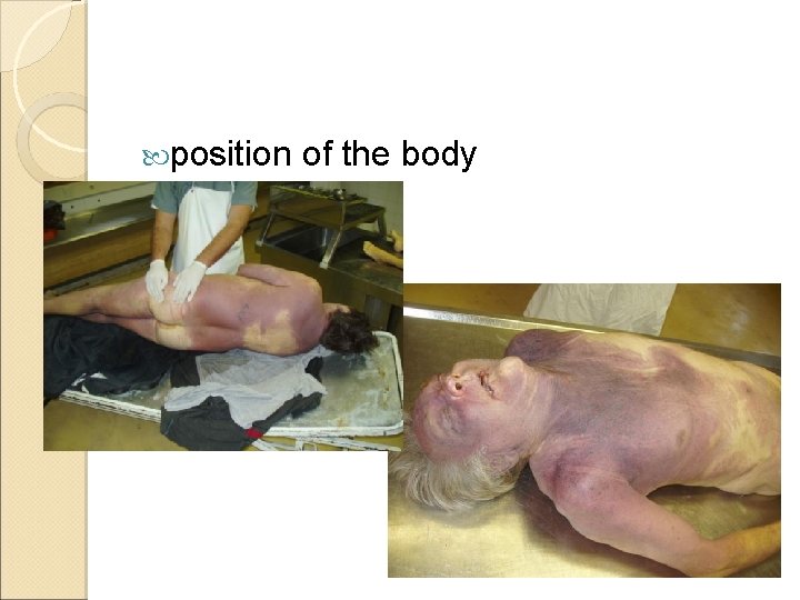  position of the body 