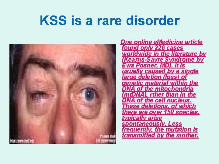 KSS is a rare disorder One online e. Medicine article found only 226 cases