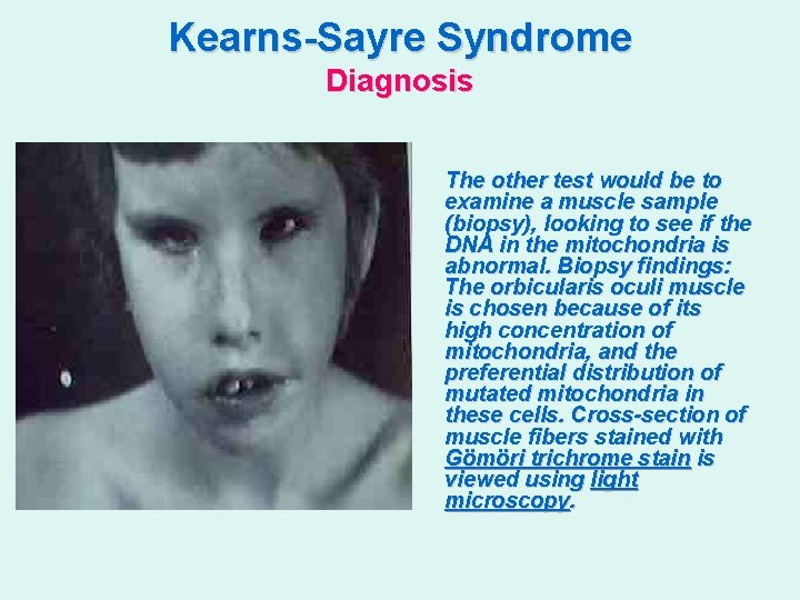 Kearns-Sayre Syndrome Diagnosis The other test would be to examine a muscle sample (biopsy),